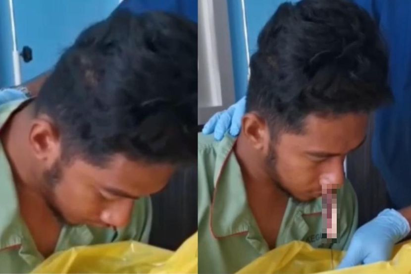 Foto Aiman menjalani rawatan resdung, daripada laporan mStar